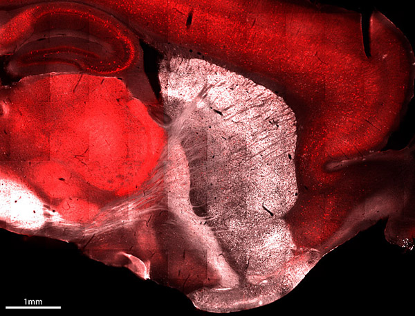 Figure 1: Visualization of different basal ganglia circuits using a reporter line... Figure 1: Visualization of different basal ganglia circuits using a reporter line...